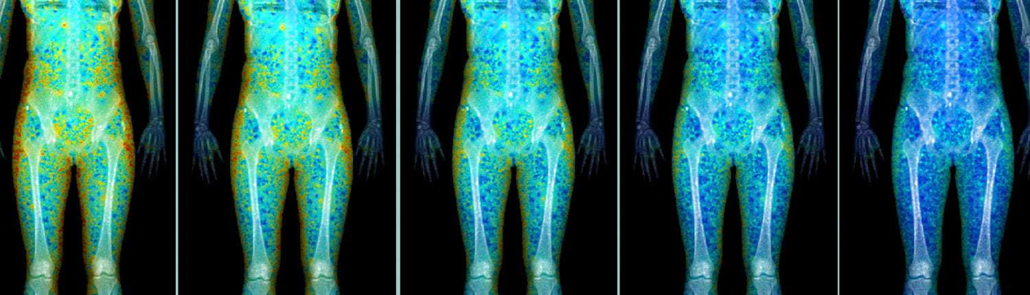 DEXA scan for determining body composition changes
